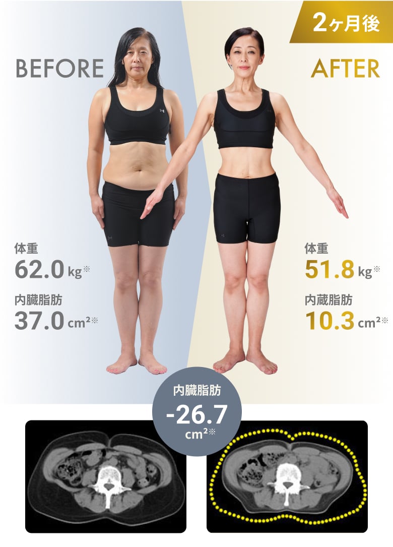 正規品、RIZAP、ライザップ3D Shepper、トレーニング、ダイエット、 Amazon.co.jp: RIZAP ライザップ 腕足用 EMS RIZAP 3D Shaper
