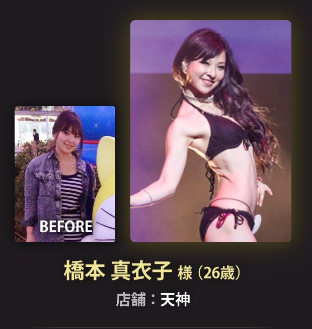 橋本 真衣子 様（26歳）天神店