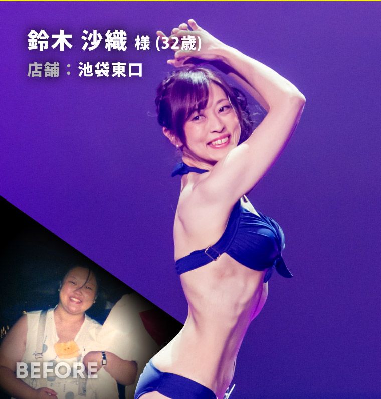 鈴木 沙織 様（32歳）池袋東口